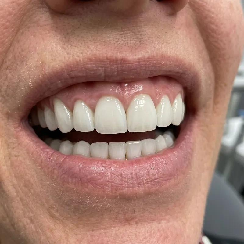 Real patient after cosmetic dentistry